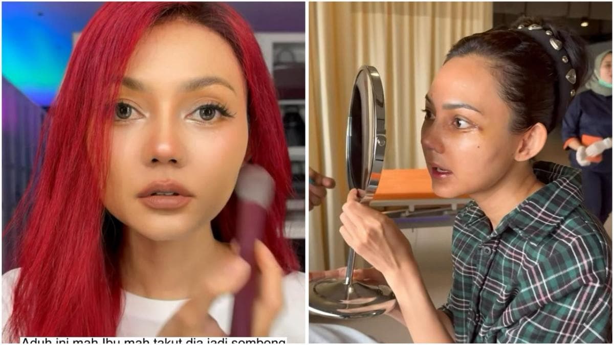 Viral Rina Nose Pamer Hidung Baru setelah Oplas, Ini Fotonya!