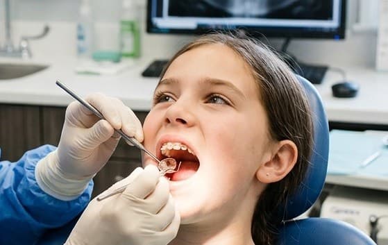 93 Persen Anak Indonesia Alami Karies Gigi, Dokter Ingatkan Cermati Kandungan pada Susu Formula 93 Persen Anak Indonesia Alami Karies Gigi, Dokter Ingatkan Cermati Kandungan pada Susu Formula