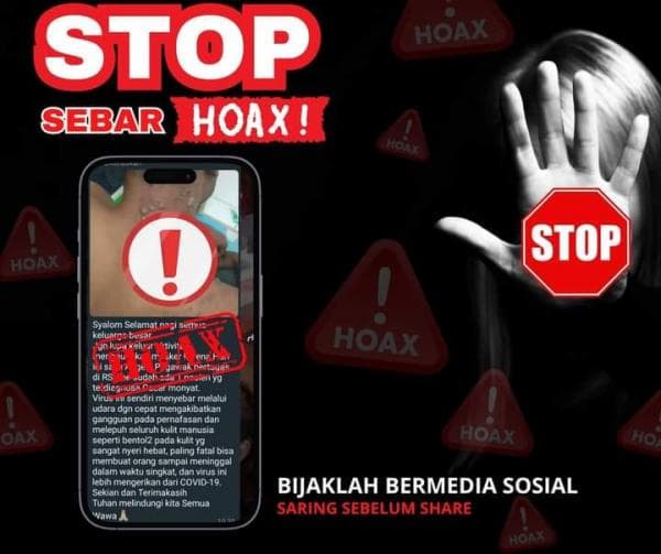 Viral Foto Pasien Diduga Terinfeksi Virus Monkeypox, Direktur RSUD Abepura Berikan Klarifikasi