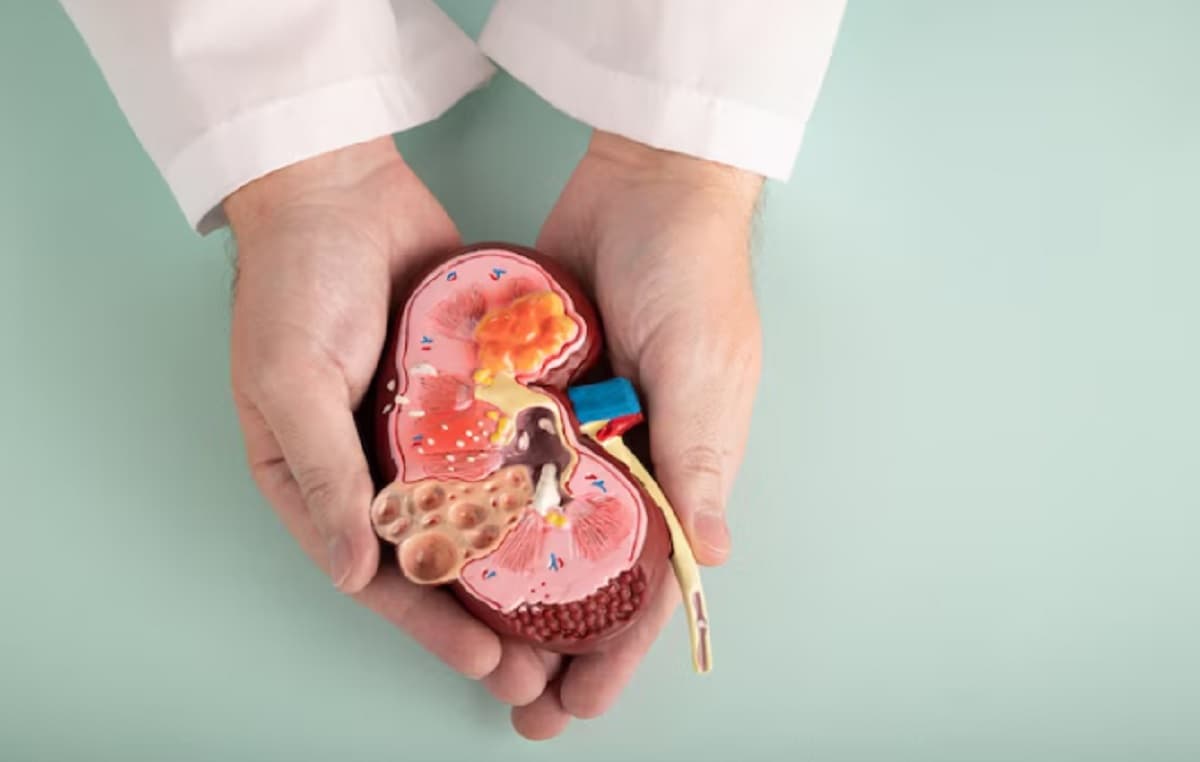 Mengenal Dialisis Mandiri CAPD, Alternatif bagi Pasien Gagal Ginjal Selain Cuci Darah