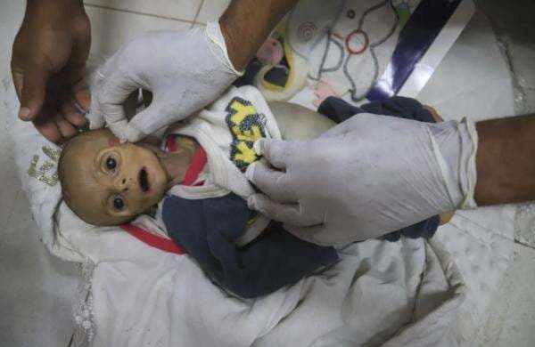 Duh, Bayi di Gaza Meninggal akibat Kedinginan