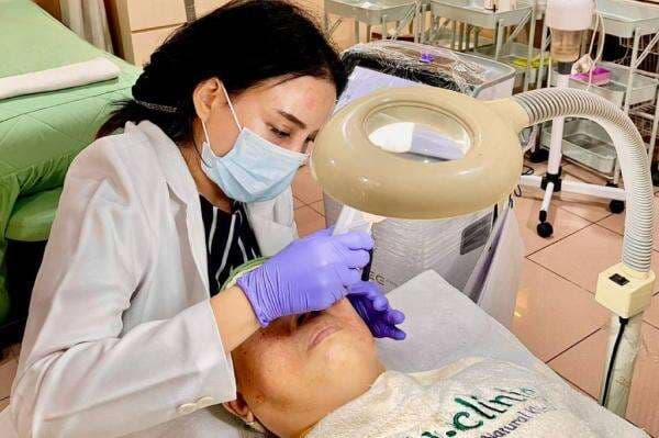 Tips Menghilangkan Flek Hitam Secara Medis, Dokter Jelaskan Perawatan Efektif dan Aman