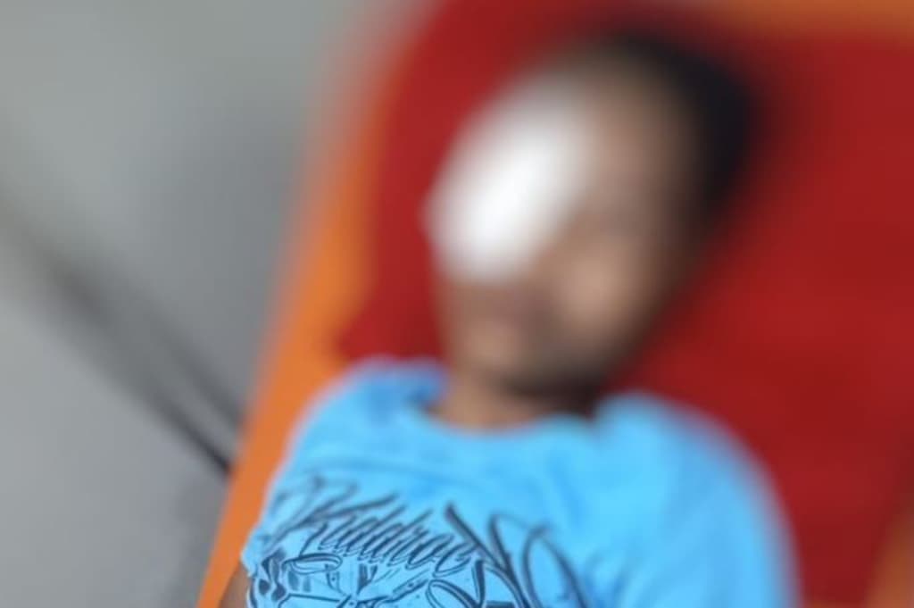 Ngeri! Mata Remaja di Gowa Tertembak Peluru Jeli saat Pulang Tarawih Ngeri! Mata Remaja di Gowa Tertembak Peluru Jeli saat Pulang Tarawih