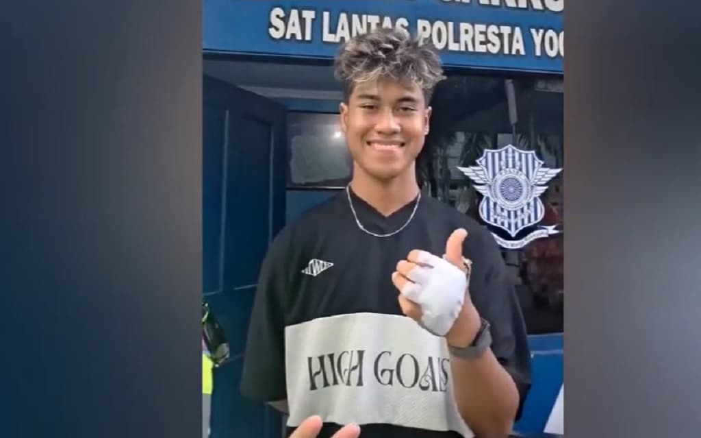 Viral Pembalap Muda Nasional Aldi Satya jadi Korban Tabrak Lari di Jogja Viral Pembalap Muda Nasional Aldi Satya jadi Korban Tabrak Lari di Jogja