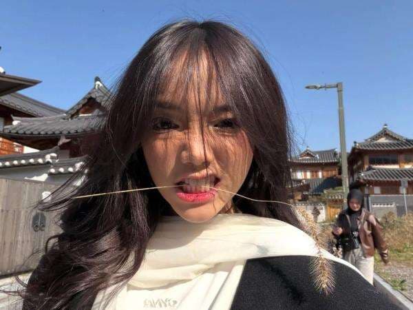 Fuji Didiagnosis ADHD, Dilarang Makan Cokelat Banyak-Banyak! Fuji Didiagnosis ADHD, Dilarang Makan Cokelat Banyak-Banyak!