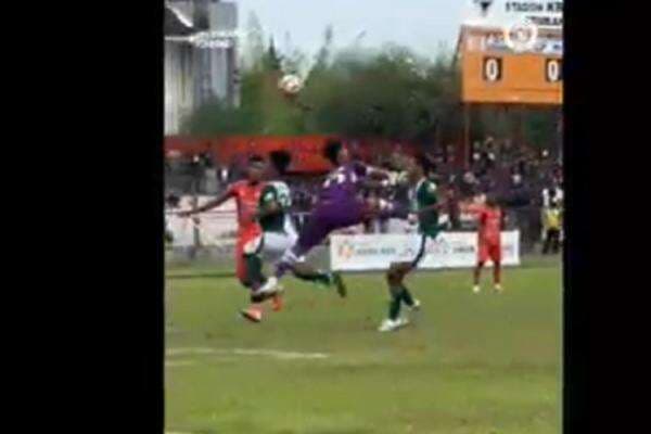 Kondisi Terkini Rizal Pemain Persikaba usai Kena Tendangan Kungfu Kiper PSIR Kondisi Terkini Rizal Pemain Persikaba usai Kena Tendangan Kungfu Kiper PSIR