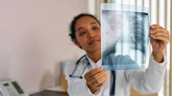 19.000 Lebih Anak Indonesia Meninggal akibat Pneumonia, Ahli Sarankan Vaksinasi 19.000 Lebih Anak Indonesia Meninggal akibat Pneumonia, Ahli Sarankan Vaksinasi